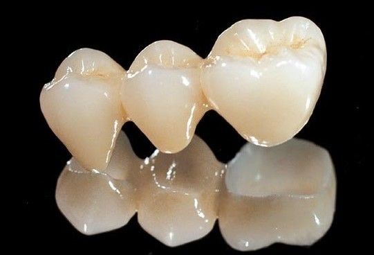 تاج دندان تمام سرامیک زیرکونیا