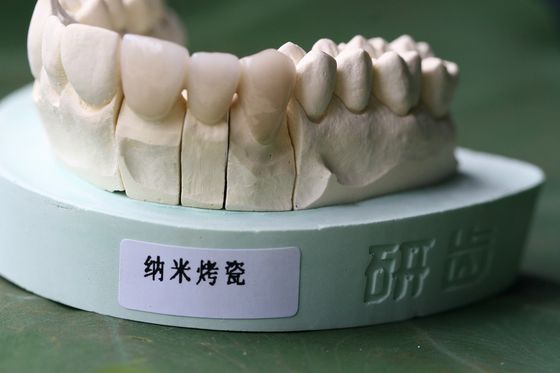 ISO13485 تاج دندانپزشکی بی ارزش سازگار با PFM غیر گرانبها
