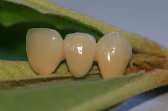ISO13485 تاج دندانپزشکی بی ارزش سازگار با PFM غیر گرانبها