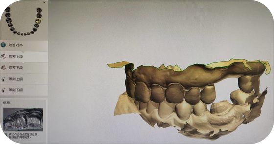 CAD Digital Visual of Oral Scanning File STL