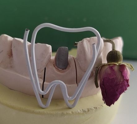 پست و هسته دندانپزشکی متال بعد از درمان ریشه