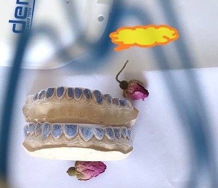 سینی سفید کننده سفارشی ISO13485 برای دندانهای سفید کننده
