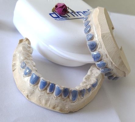 راهنمای سفید کننده فویل ترموفرمینگ Premade برای افراد سیگاری