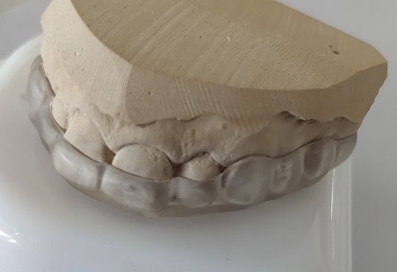 قطعات زیبایی دهان قوس پایین برای جمع شدن دندان ها