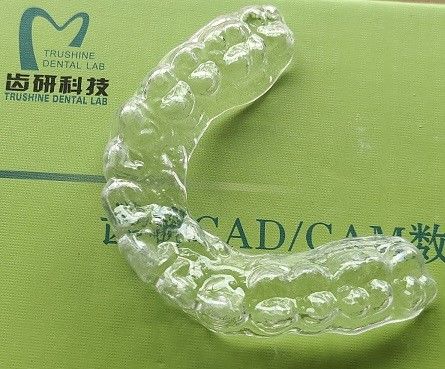 محافظ دهان راحت دهان فوقانی آکل آتل (Occlusal Splint) برای دندان قروچه