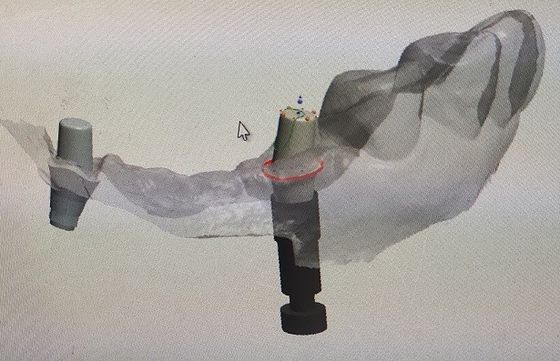 CAD Digital Visual of Oral Scanning File STL