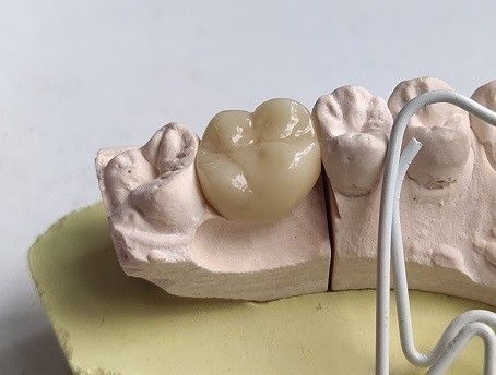 دندانهای زیرکونیا مکعب چینی