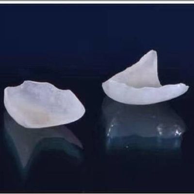 تاج دندانپزشکی EMAX با روکش طبیعی تمام روکش های چینی