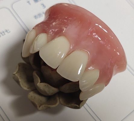 ISO13485 پروتز معمولی اکریلیک فوقانی جزئی