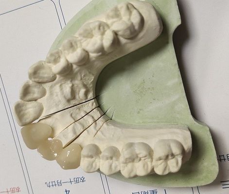 تاج موقت CAD Technique ISO13485