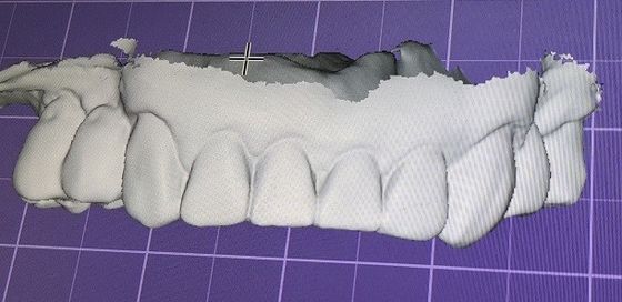 3D Digital Mock Up دندان سایر محصولات دندانپزشکی