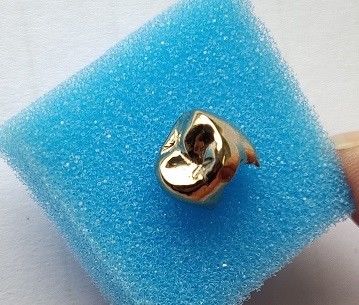 تاج دندانپزشکی تمام فلزی High Noble Gold