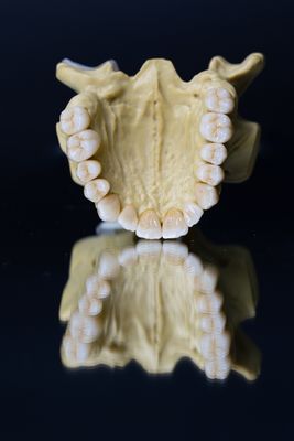 تاج دندانپزشکی آزمایشگاه دندانپزشکی Porcelain Zirconia 5 ستاره زیبایی