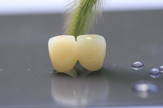3D Print Framework PFM Dental Lab Crown For Dentistry