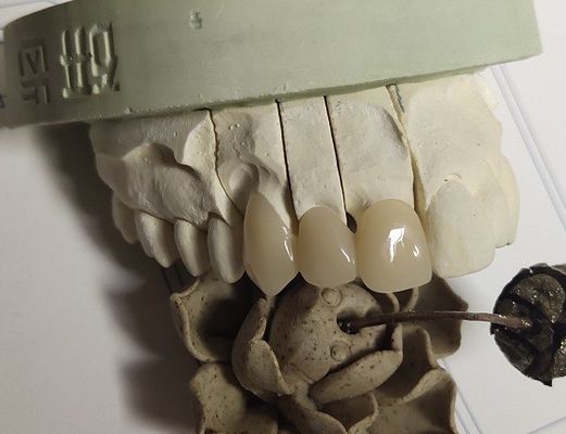 تاج موقت CAD Technique ISO13485